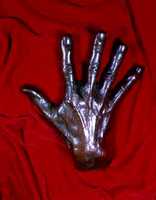 Cast of the Hand of Harvey Cushing