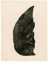 Photograph of a right lung from Camp Devens Case 195