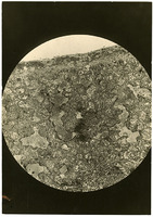 Photograph of a microscope slide from Camp Devens Case 193