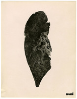 Photograph of a lower lung from Camp Devens Case 198