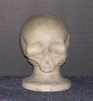Phrenology cast of skull of Madeline Albert, 1811-1835