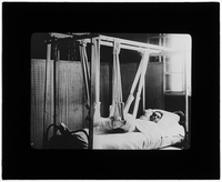 Patient in bed with leg in cast raised in slings