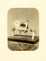 Photographs of Charles Lowell&#039;s hip bone mounted on display