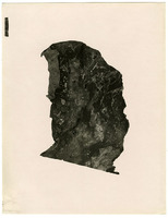 Photograph of a lung slide from Camp Devens Case 204