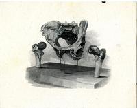 Engraving of Charles Lowell&#039;s hip bone