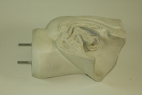 Dickinson-Belskie model of female pelvic organs, 1945-2007
