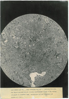 Photograph of a microscope slide from Camp Devens Case 214