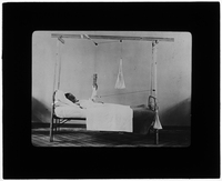 Patient in bed with arm in cast raised with pulley