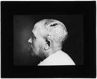 Patient with scalp injury
