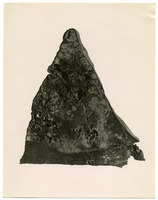 Photograph of the lower lobe of a right lung from Camp Devens Case 212