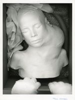 Digital print of cast of child with tumor
