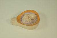 Replica of Dickinson-Belskie model of fetus in uterus, 4.5 months developed, 1945-2007