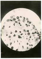 Photograph of a microscope slide from Camp Devens Case 183