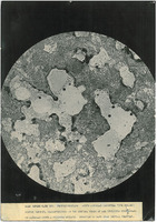 Photograph of a microscope slide from Camp Devens Case 192