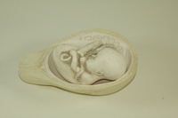 Dickinson -Belskie model of uterus with removable fetus, 1945-2007